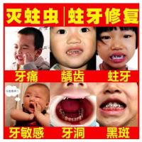 小孩蛀牙蚜虫牙洞牙痛特效牙疼牙痛宁喷剂牙痛立可停牙疼牙龈肿痛