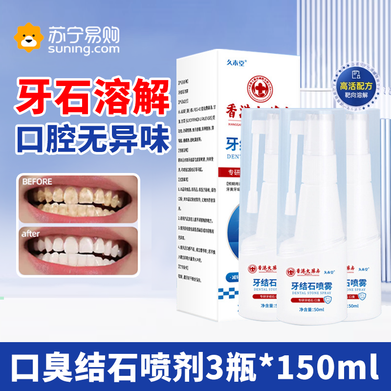牙结石去除器溶解除非速效漱口水洗牙齿污垢牙黄牙垢清除3425-02高清大图