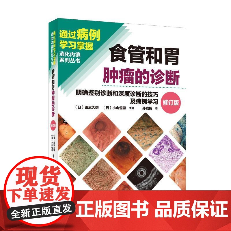 预售 食管和胃肿瘤的诊断 (日)田尻久雄,(日)小山恒男 著 肿瘤学生活 正版图书籍 辽宁科学技术出版社高清大图