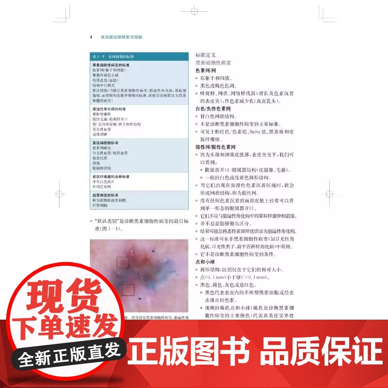 皮肤镜诊断精要与图解 涉及病例数多达105例 图片为主 细致的分析 皮肤科医学书 皮肤镜诊断图谱 皮肤镜标准综述 皮肤病高清大图