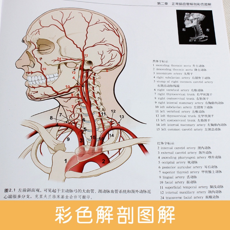 [醉染正版]脑血管解剖及病理三维血管造影图谱(精装彩图)人体脑血管解剖学图谱神经外科医生技术参考书动脉静脉医学书 辽宁科高清大图