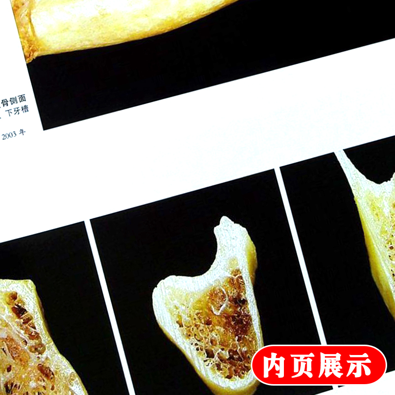 [正版]口腔种植学 第二2版 宿玉成 入门美学修复根管治疗正畸拔牙数字化工艺精准植入技巧满毅人民卫生出版社口腔科种植牙高清大图