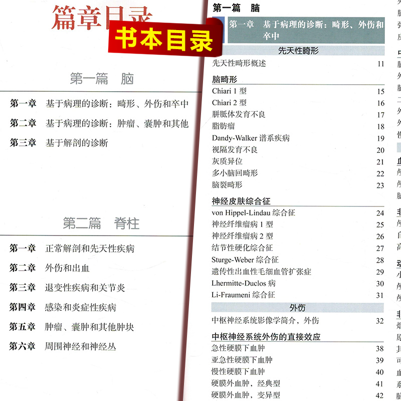[正版] 神经影像学 娄昕 江桂华主译 神经系统影像神经科医生参考书籍 北京大学医学出版社9787565918667高清大图