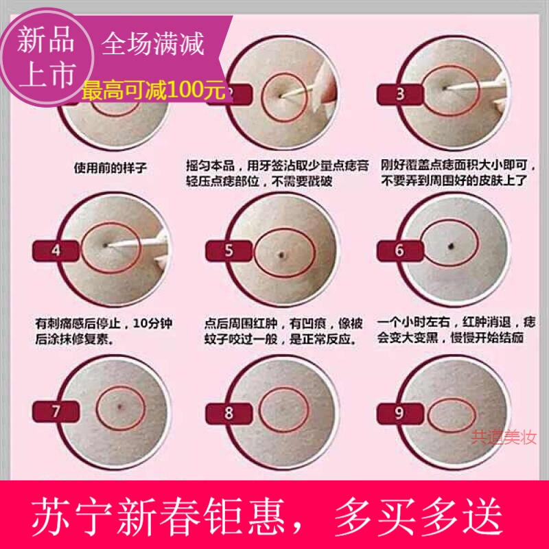 2019新春钜惠】祛痣韦医生除痣灵套装除黑痣