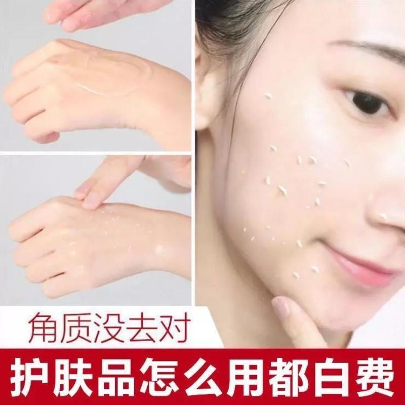 果酸去角质面部女学生皮美白去脸部黑头深层清洁啫喱全身身体 [1支]果酸去角质250g