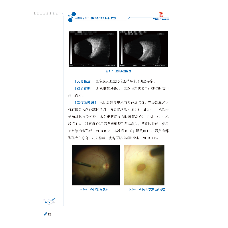 醉染图书南昌大学第二附属医院眼科病例精解9787518965403高清大图