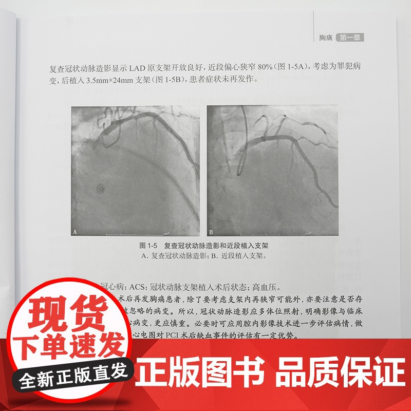 心血管疾病常见症状体征鉴别——附典型病例分析 张军主编 供心血管科主治医师住院医师研究生其他临床相关科室的医师等阅读 人高清大图