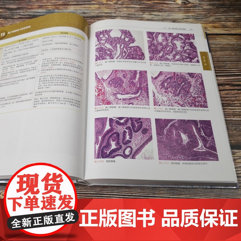 外科病理鉴别诊断图谱 消化系统 病理医学 外科病理 鉴别 图谱 消化 包括常见的实体病变和一些较罕见的疾病 北京科学技术高清大图