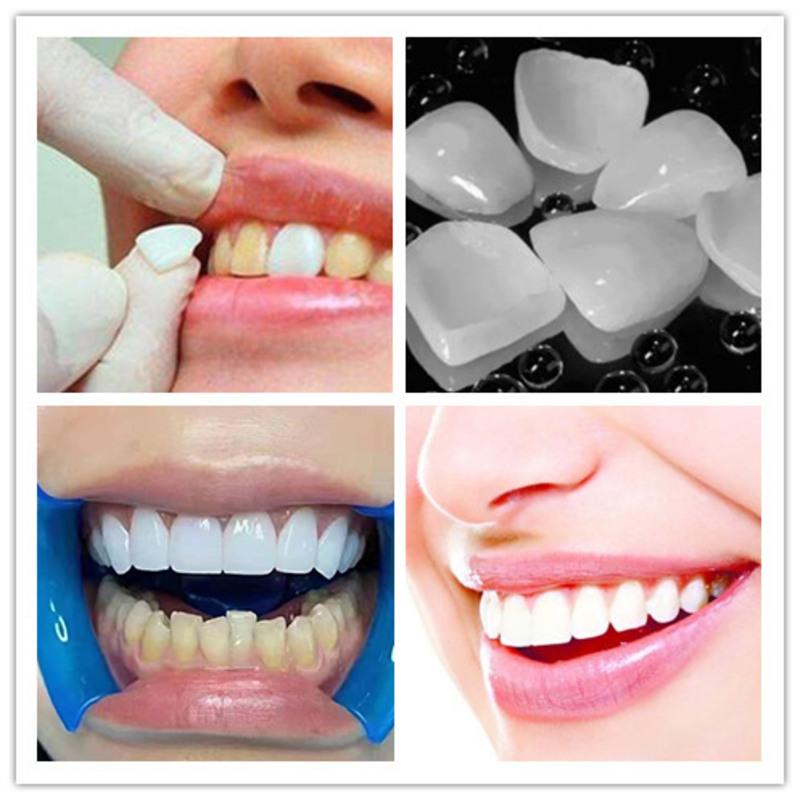 【牙贴面】报价行情_排行_品牌_参数_怎么样_图片_商家-苏宁易购