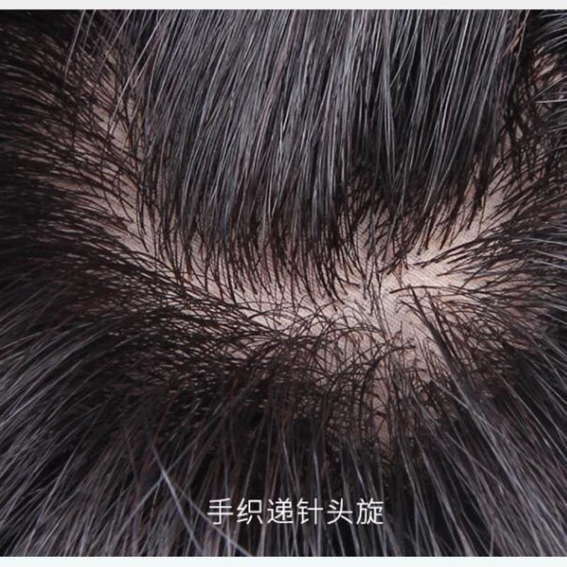 遮白发假发片一片式真发头顶补发片女烫发增发量蓬松短卷发羊毛卷 递针头顶真发深棕色15厘米(9*9)