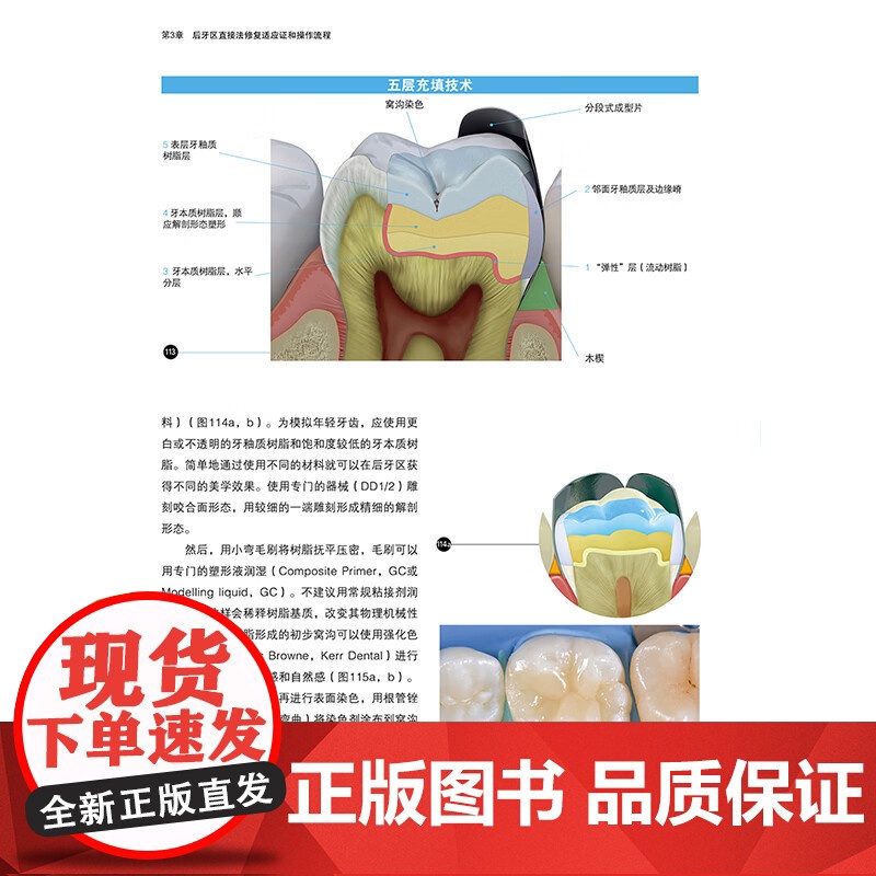 [出版社]全2册微创修复解决方案2本套装非龋性牙体硬组织疾病 牙体修复概论 传统粘接固位修复体 刘擎 辽宁科学技术出版社高清大图