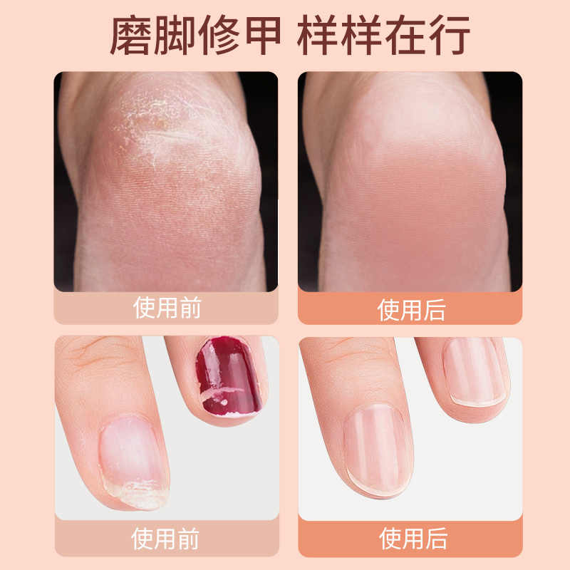 美克斯(MKS)专业型修脚神器电动磨脚器修足器充电式磨脚后跟去脚皮死皮磨甲器多功能高端去角质器 NV8615E!高清大图