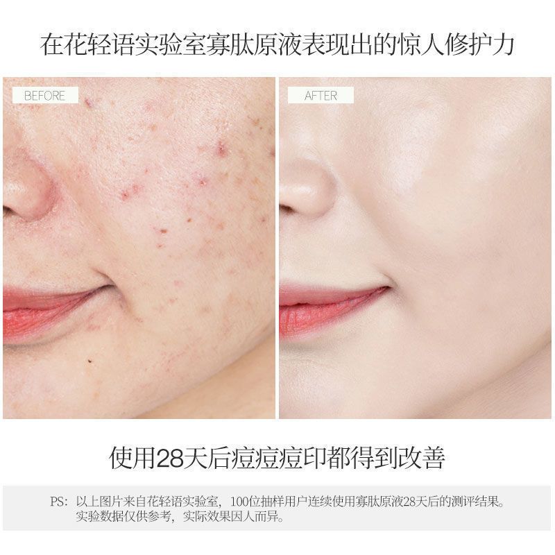 寡肽原液去淡化痘印痘疤面部修复精华液冻干粉护肤品女男美容 寡肽原液单支装