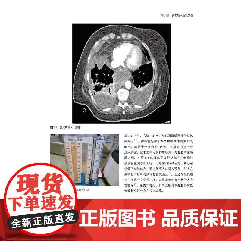 消化道术后并发症实例分析 本书为每种并发症都配有2到3个病例 所有病例均来自作者的临床手术实践 是第一手的珍贵资料高清大图