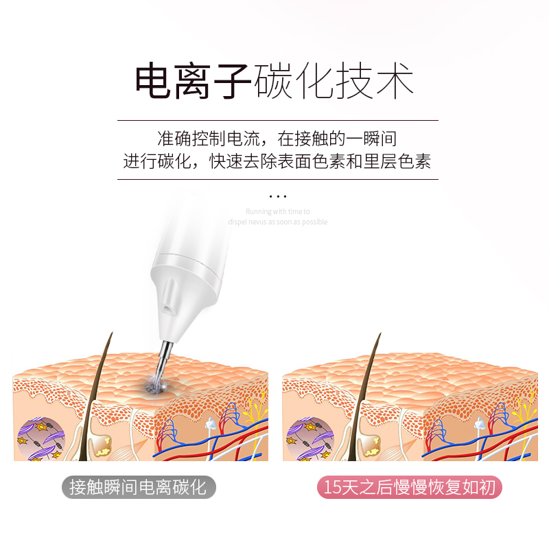 金稻点痣笔去斑去痣神器祛痣无痕正品脸部祛斑小白美容院专用718[白色]