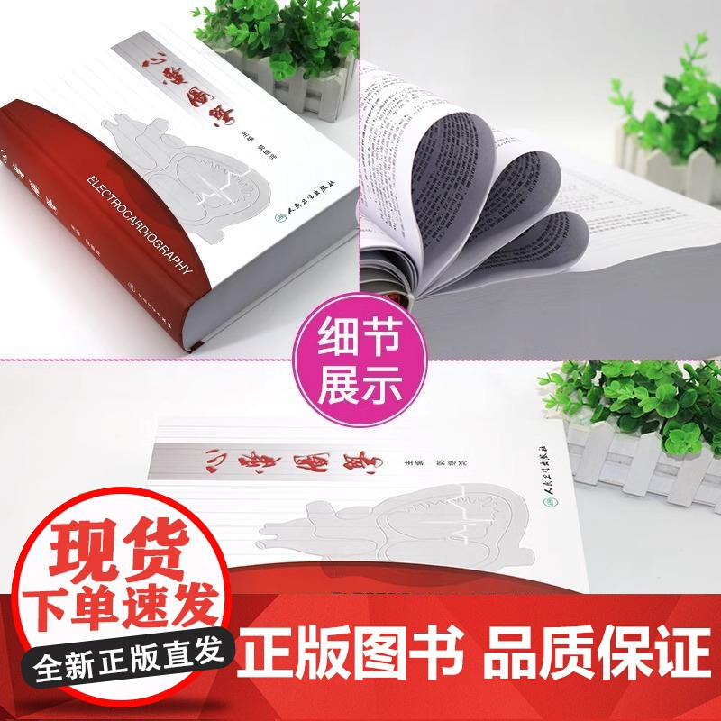 心电图学 心电图电生理学和心电检查学 郭继鸿主编 心电图诊断 内科急诊科心血管专科医生参考书 人民卫生出版社978711