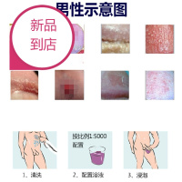 晓暮匠高锰酸钾溶液男用垢珍珠下体消毒液高猛酸钾洗液
