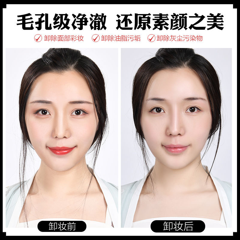 美康粉黛(MEIKING)酵母卸妆水 脸部温和 清洁无刺激眼唇卸妆液女按压瓶