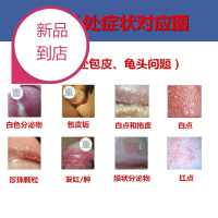 晓暮匠高锰酸钾溶液男用垢珍珠下体消毒液高猛酸钾洗液
