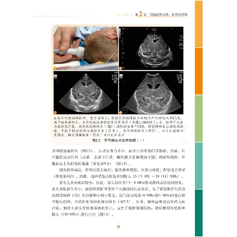 诺森新生儿颅脑超声269787518992935科学技术文献出版社高清大图