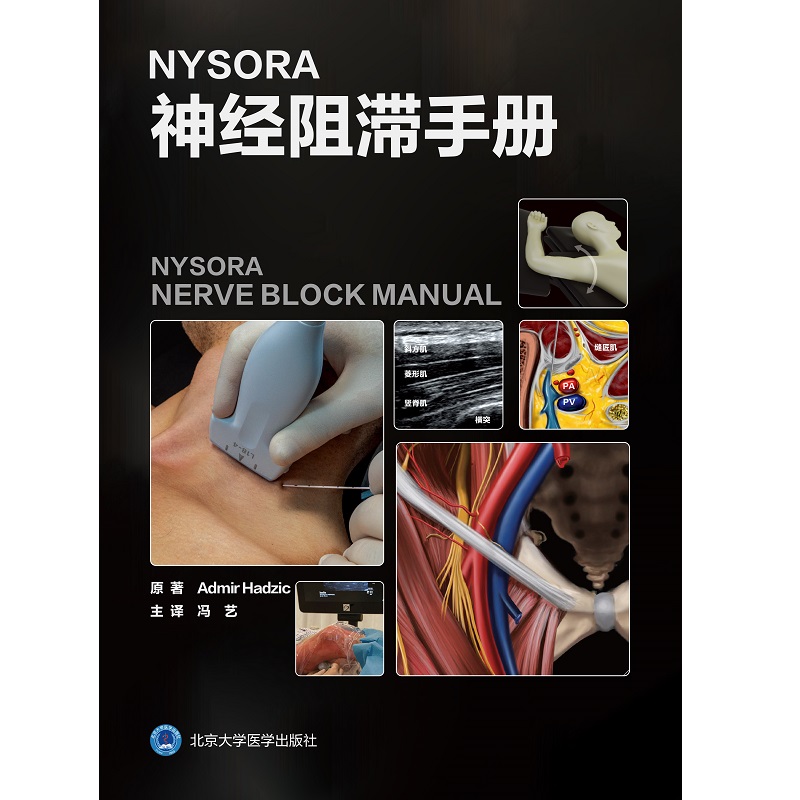NYSORA神经阻滞手册 美 阿迪曼尔哈季奇 完整标准的实用知识以及临床上 适用的实践技术与引用大量的文献 北 [正版]高清大图