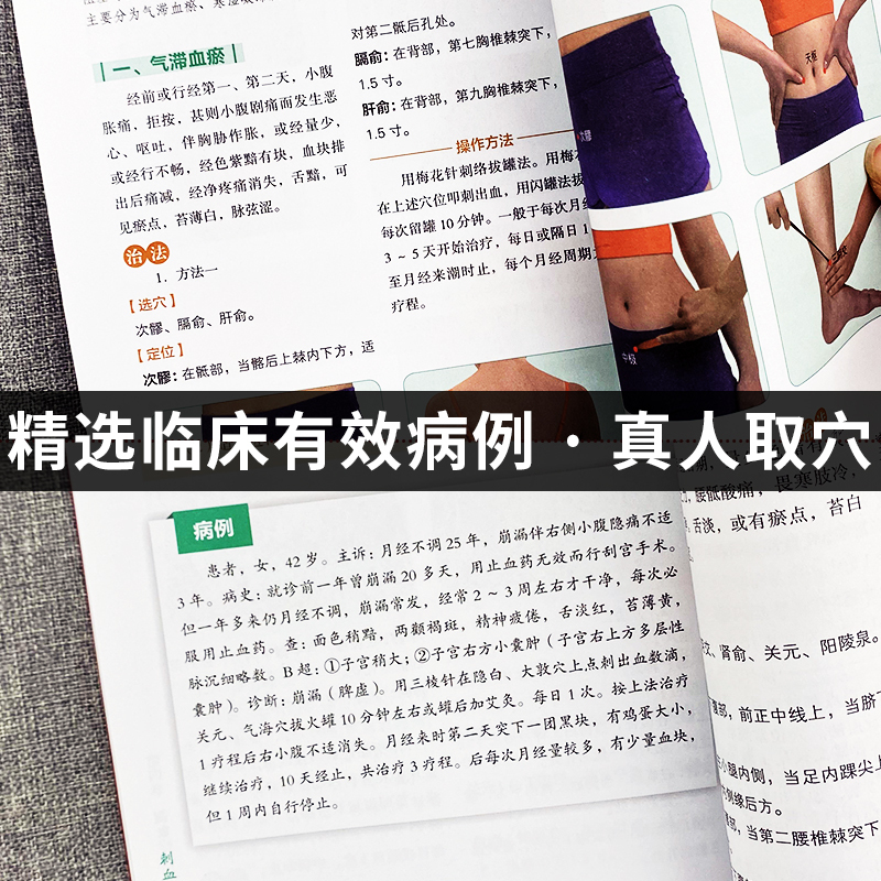 [7册]刺血治病 找穴取穴 人体经络 食疗等书 [正版] 刺血治病一本通 图解人体经络穴位刺血疗法书 中医常见疾病临床诊