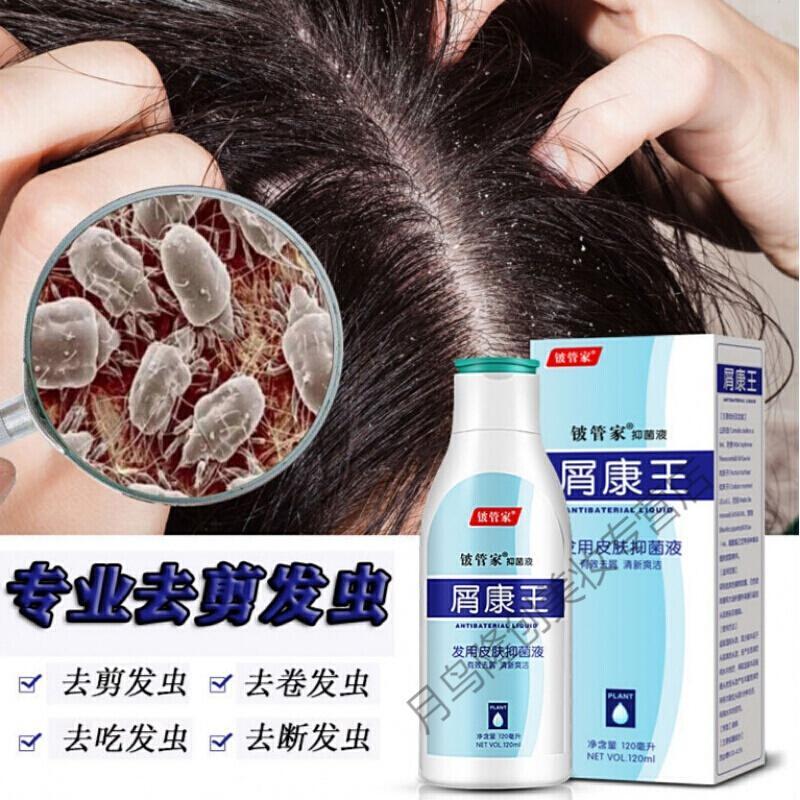 洗发水去卷发虫除吃发虫防发中儿童缠发断发虫剪发虫洗发水