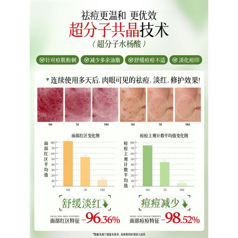 儒意水杨酸清透焕肤面膜25ml*20片高清大图