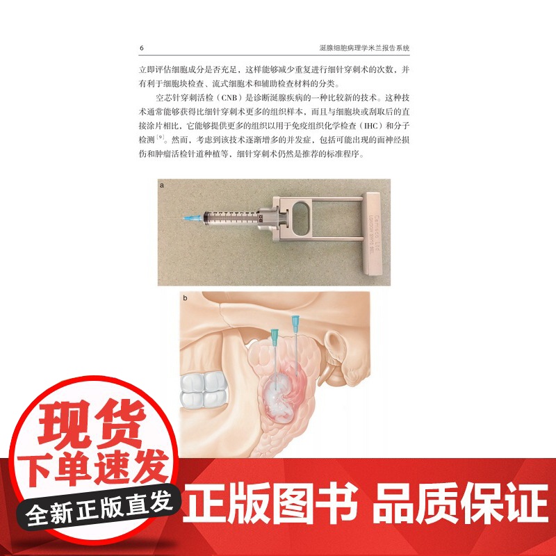 涎腺细胞病理学米兰报告系统 北京科学技术高清大图