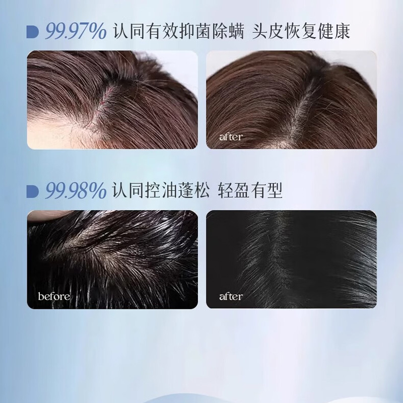 [八钢专用]小米儒意二硫化硒净屑清爽洗发水500ml高清大图