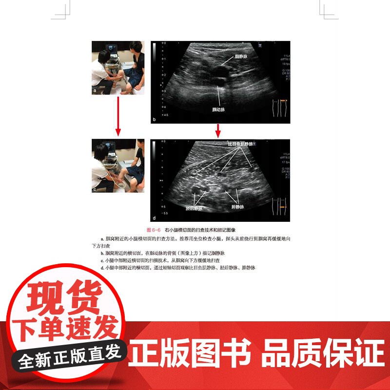 床旁即时超声 全书共10章 介绍了床旁超声在气道管理 呼吸系统 循环系统 中枢神经系统 下肢静脉血栓 腹部 运动系统 血高清大图