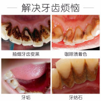 竹炭黑牙粉洗牙粉牙齿美白洁牙粉白牙素牙贴去咖啡渍去牙垢去黄去茶渍牙吸烟人群去烟渍 50g