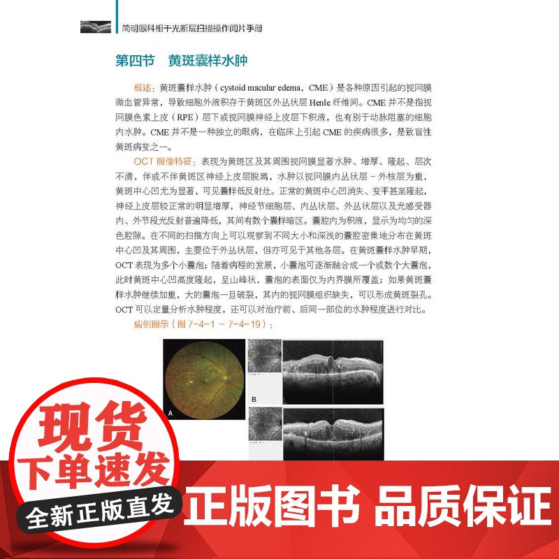 简明眼科相干光断层扫描操作阅片手册 图文并茂 病例分析 北京科学技术高清大图