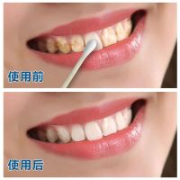 （拍2发3盒）正品樱瑞珍珠亮白洁牙粉白牙素除去黄牙50g烟牙去牙垢烟渍牙结石非牙贴成人口腔护理牙斑净