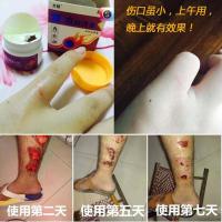 专营）生肌膏成人小孩獾油烧烫伤膏祛去腐宝宝开水烫火创面伤口愈合