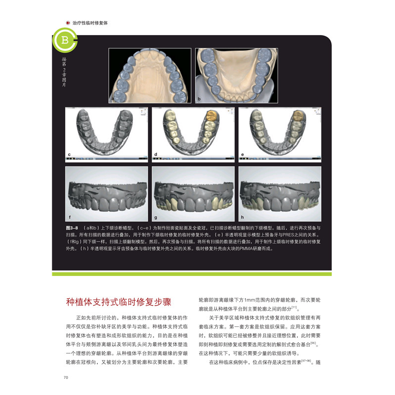 醉染图书以修复为导向的软组织管理9787559114150高清大图