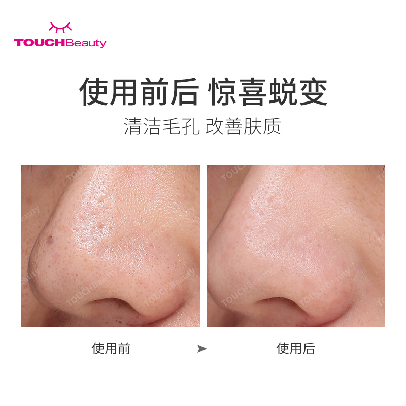 TOUCHBeauty黑头仪 声波黑头铲皮机 毛孔清洁去粉刺洁面仪 精华导入美容仪 超声波黑头仪1887