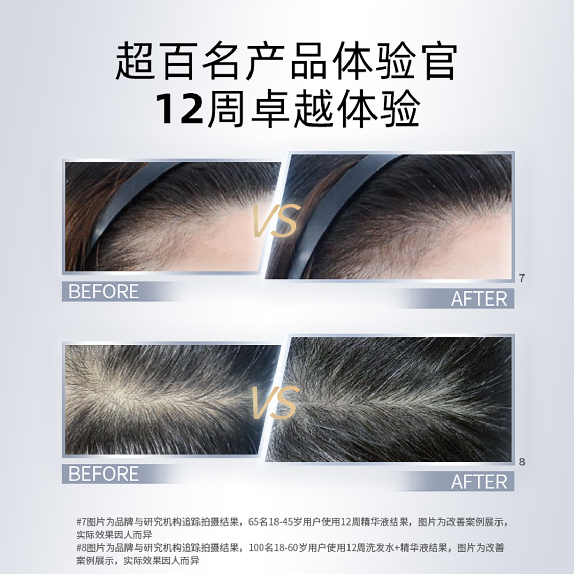 拜耳康王防脱精华腺苷育发小银瓶洗发水赋活育发液密发固发防 拜耳康王防脱精华液10ml高清大图