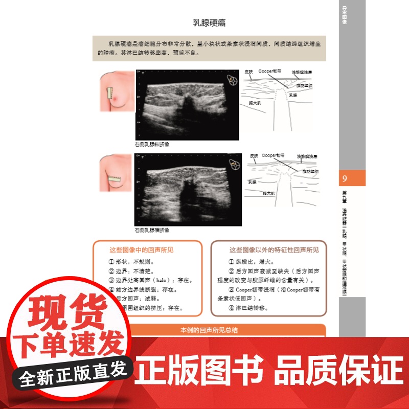 超声解剖及扫查技巧图解 新手入门超声基础实际操作 北京科学技术出版社高清大图