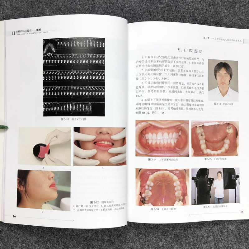 [正版] 口腔种植临床操作图解 拔牙技巧学义齿全瓷修复颌面外科正畸黏膜病学牙髓之路儿童牙科病历根管治疗口腔医学书籍高清大图