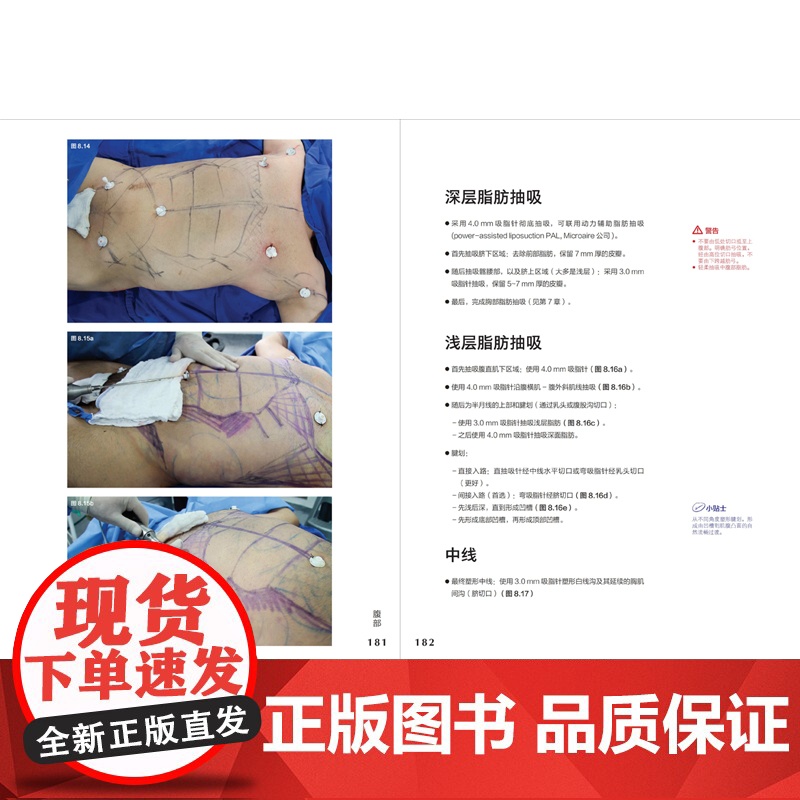 形体精雕诠述:高阶技能图谱高清大图