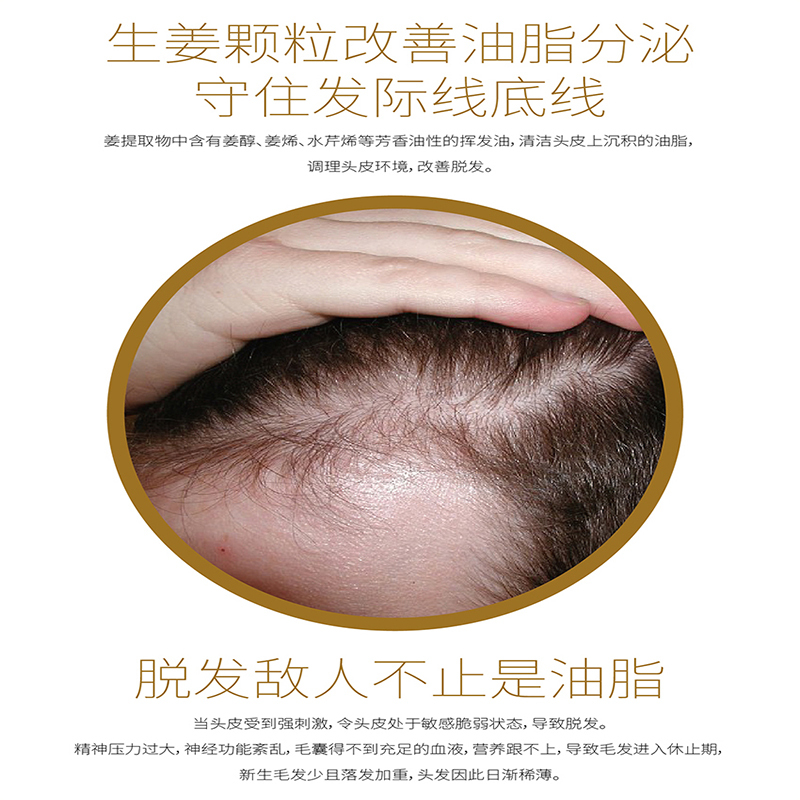 琴叶生姜防脱发控油洗发水姜汁增发去屑止痒洗发露姜王育发