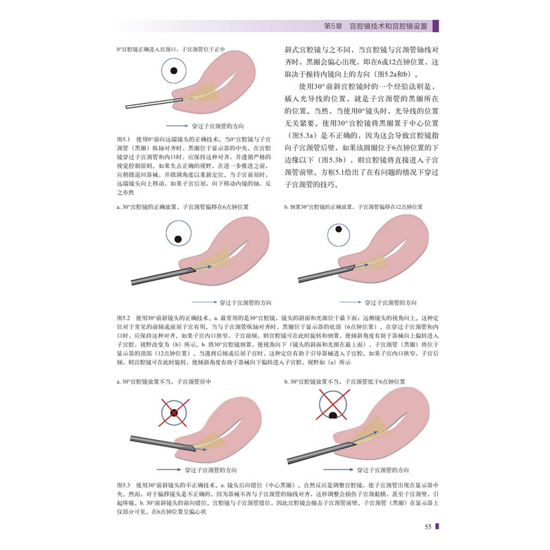 醉染图书宫腔镜的诊断及手术技巧9787571421670高清大图
