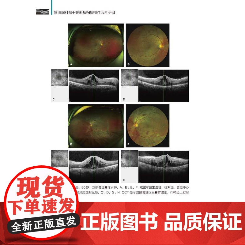 简明眼科相干光断层扫描操作阅片手册 图文并茂 病例分析 北京科学技术高清大图