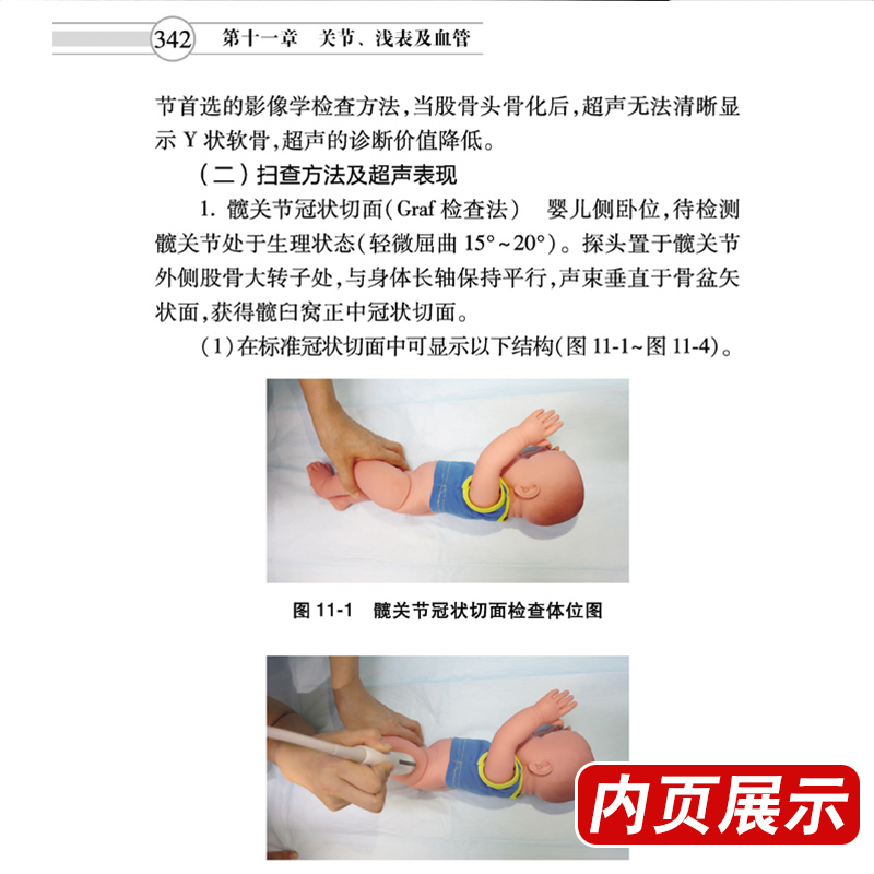 [正版] 中国儿科超声检查指南 中国医师协会超声医师分会指南丛书 超声波诊断 影像医学 小儿疾病 人民卫生出版社9高清大图