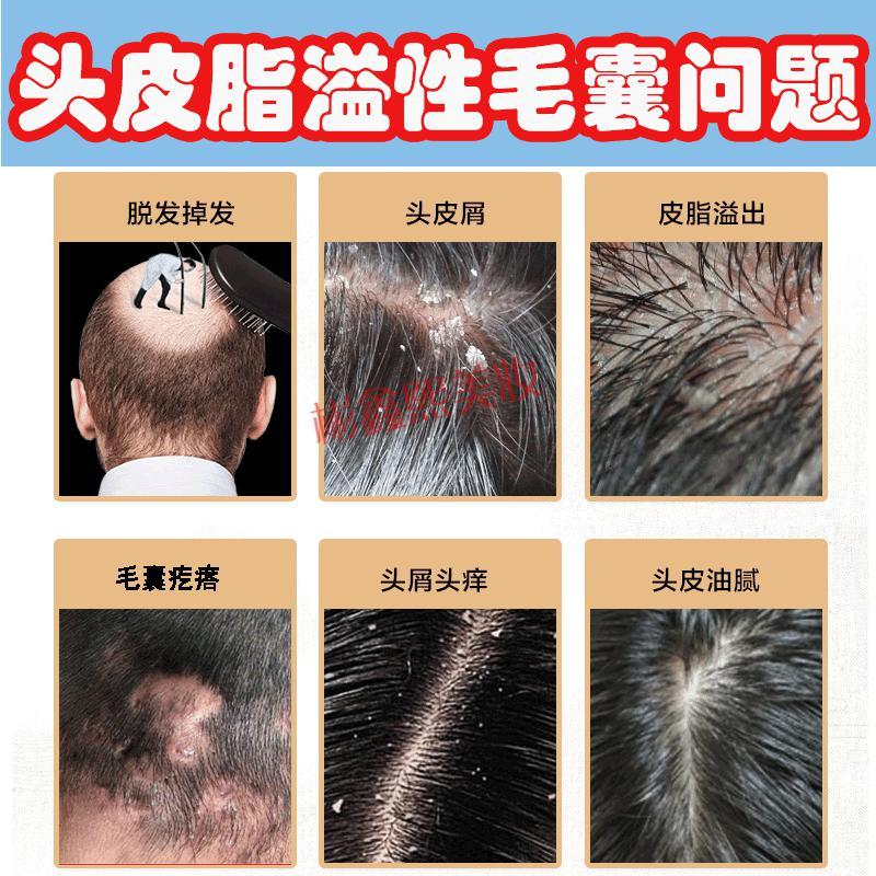 樱萃洗发水报价_参数_图片_视频_怎么样_问答-苏宁易购