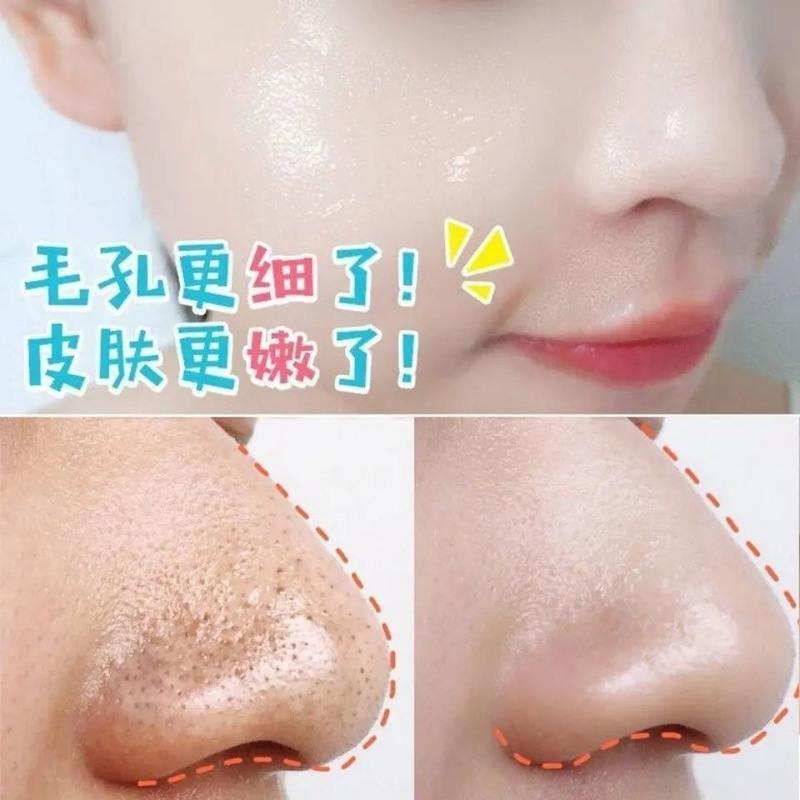 单瓶体验装 收缩毛孔去黑头去痘印去角质粉刺毛孔粗大修复精华液补水男女学生