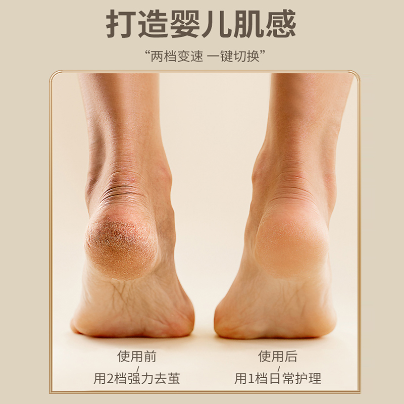志高(CHIGO)电动磨脚皮充电式自动磨脚去脚皮死皮老茧刀修足机修脚器 土豪金(采光调速)+6个磨头