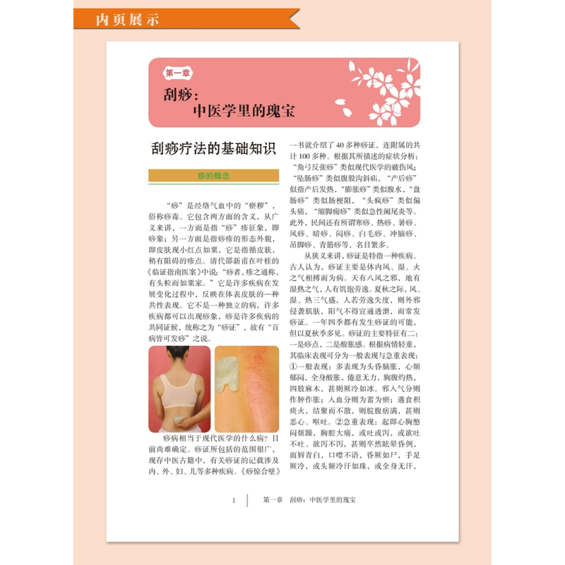 [正版]刮到病除 对症刮痧祛百病彩图版精装 刮痧自然疗法使用器具操作技巧动作示范 现代家庭中医养生保健书籍 军事医学科学