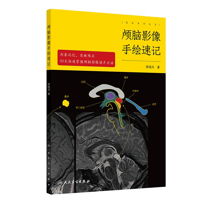 颅脑影像手绘速记 颅脑正常影像 高血压性脑出血 脑静脉出血和静脉窦血栓形成 颅内肿瘤 主编 徐桂兴 9787117 [正高清大图